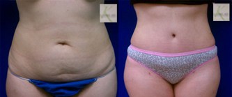 Before-slide 6