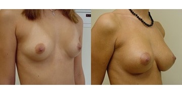 Before-slide 1