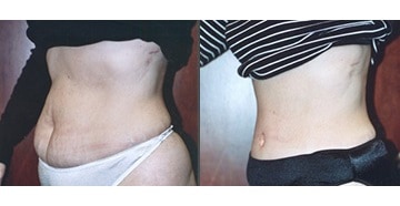 Before-slide 1